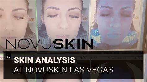 novuskin las vegas website.